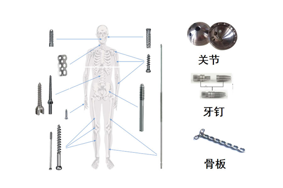 醫(yī)療骨科、牙釘、脊椎